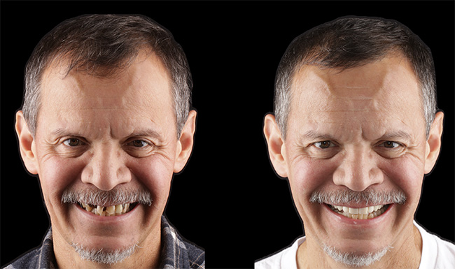 Steger Smiles Family Dentistry | CBCT, Dentures and E4D