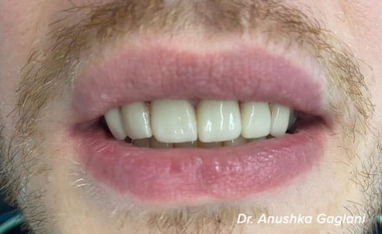 Family Dentist in Steger IL