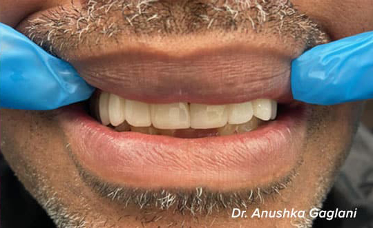 Dentist in Steger IL