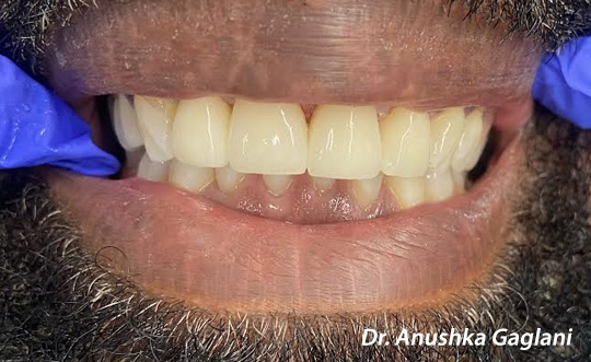 Steger Smiles Family Dentistry | Digital Scanners, Digital Radiography and CBCT