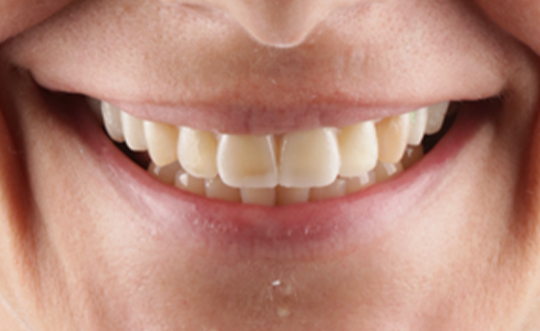 Steger Smiles Family Dentistry | Pediatric Dentistry, Oral Exams and Emergency Treatment