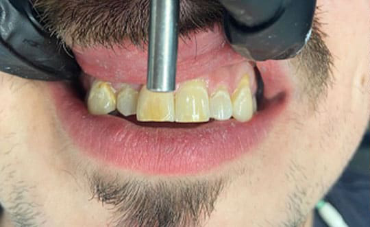 Family Dentist in Steger IL