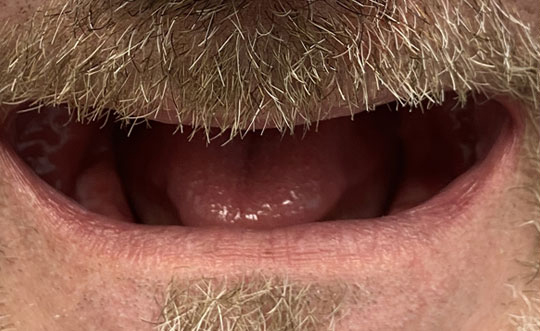 Steger IL Cosmetic Dentist