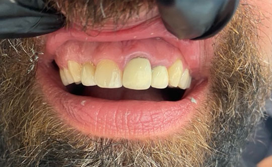 Steger IL Cosmetic Dentist