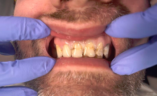 Steger Smiles Family Dentistry | Laser Dentistry, Implant Dentistry and Cosmetic Dentistry