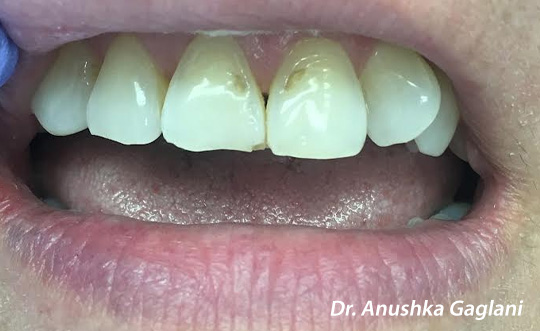 Steger Smiles Family Dentistry | Periodontal Treatment, E4D and Preventative Program