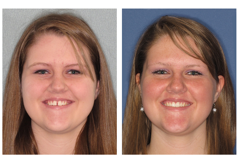 Steger Smiles Family Dentistry