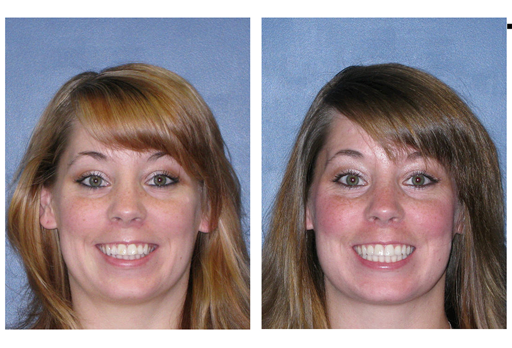 Steger Smiles Family Dentistry