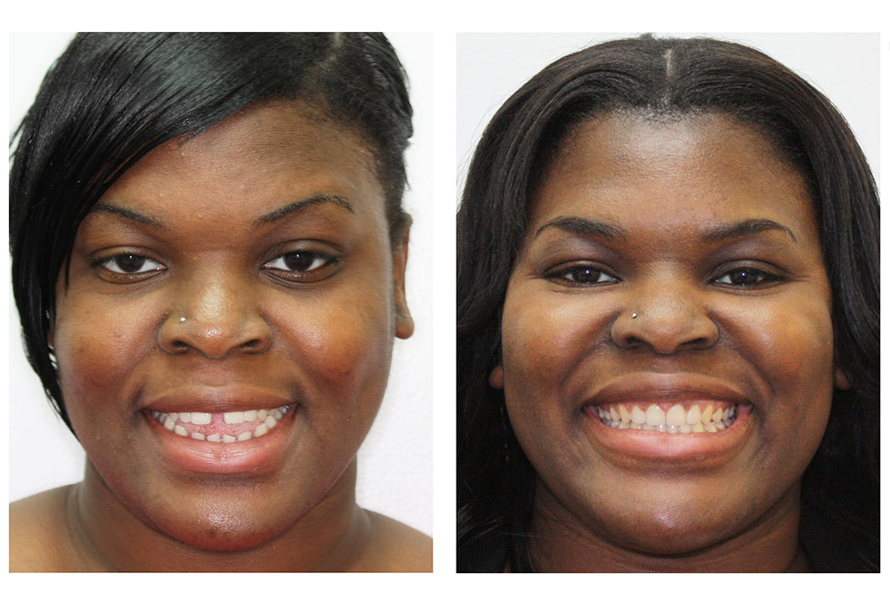 Steger Smiles Family Dentistry