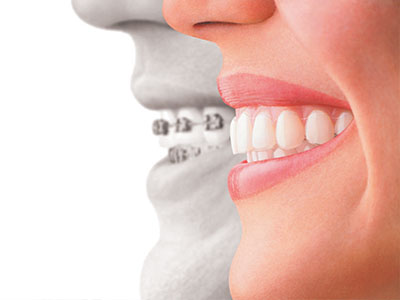 Steger Smiles Family Dentistry | Implant Dentistry, All-on-6 and Oral Exams