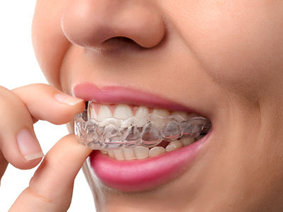 Steger Smiles Family Dentistry | Preventative Program, Oral Exams and E4D