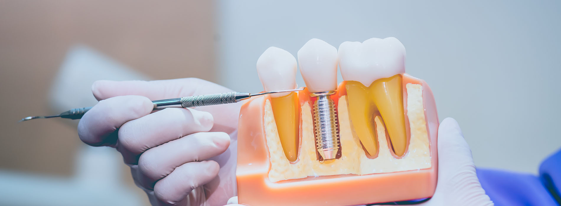 Steger Smiles Family Dentistry | Botox reg , Oral Exams and Dental Fillings
